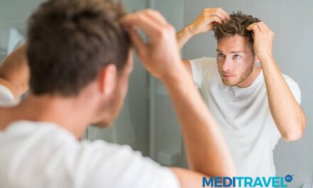 Dlaczego Łysienie Nie Musi Być Trwałe?